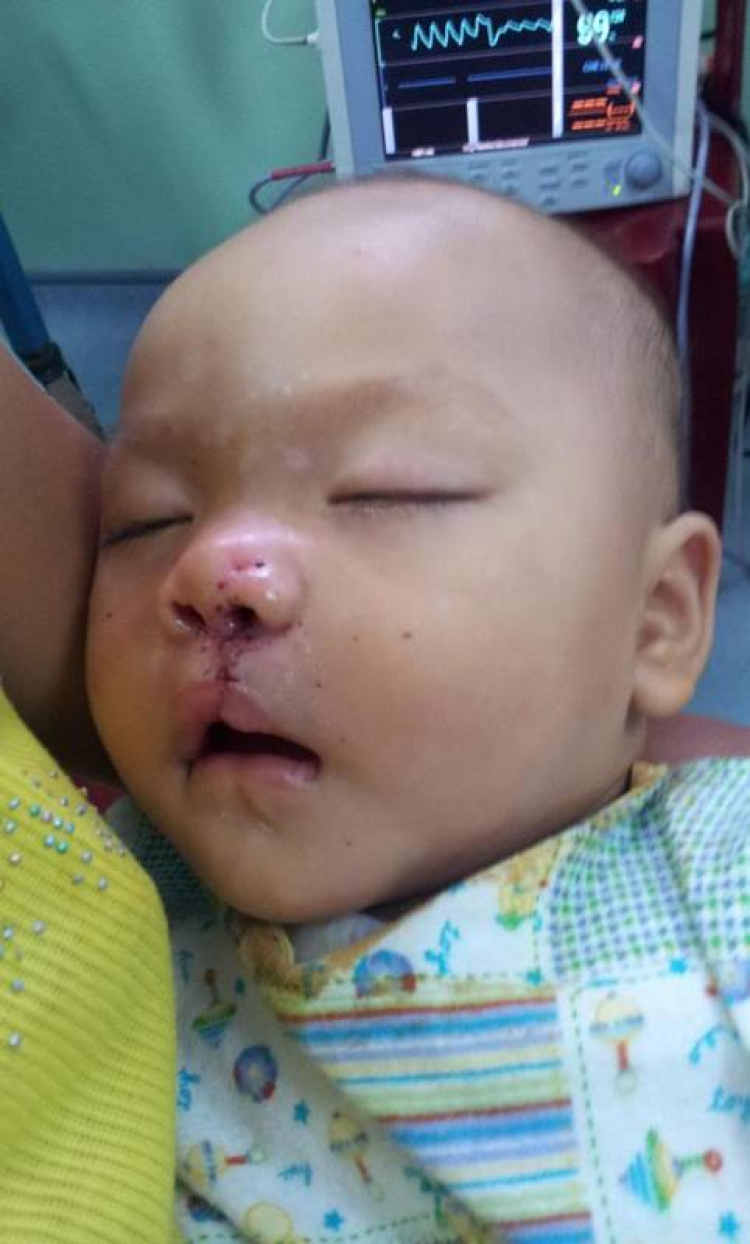 Quảng Ngãi, mang nụ cười đến cho trẻ con ! (Hình trẻ em bị tật, cân nhắc trước khi xem ) Quảng Ngãi, mang nụ cười đến cho trẻ con ! (Hình trẻ em bị tật, cân nhắc trước khi xem )