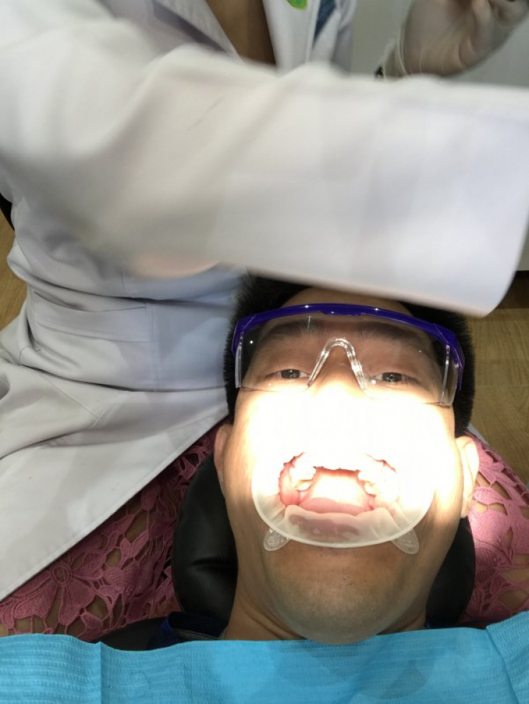 Hỏi về răng