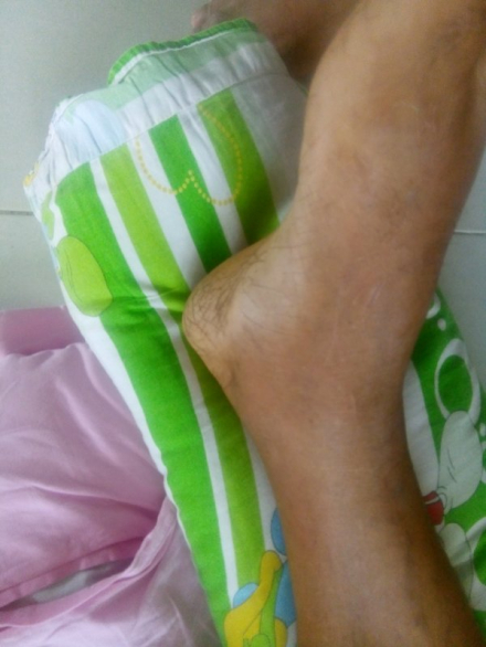 Trợ giúp điều trị bệnh Gout