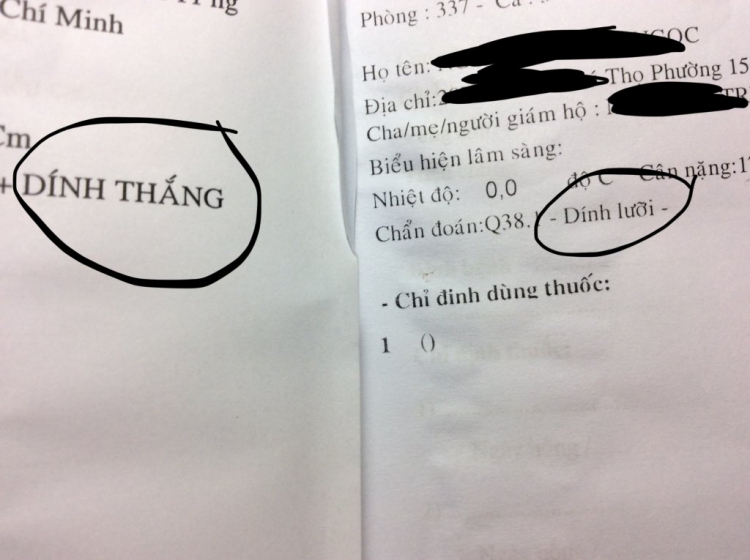 có nên mổ cắt dây thắng lưỡi cho trẻ