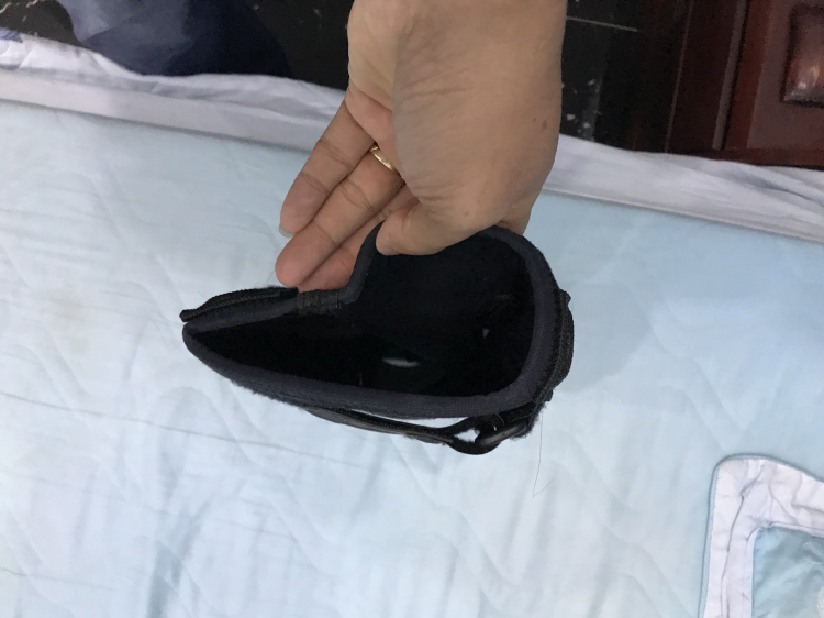 Có nên mổ khớp gối? Có nên mổ khớp gối?