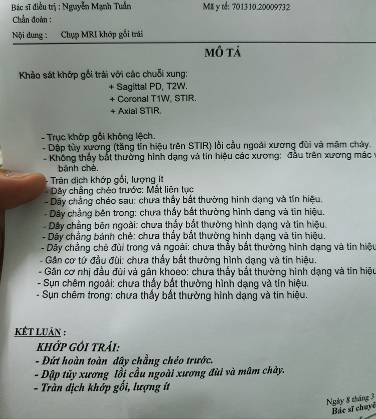 Hic...đứt dây chằng chéo trước dồi.