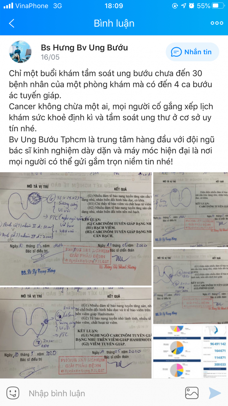 E nhờ các bác -ung thư tuyến giáp mổ Chợ Rẫy/UB E nhờ các bác -ung thư tuyến giáp mổ Chợ Rẫy/UB