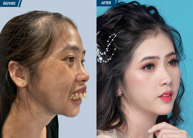 Nên mua Cross V hay G rồi độ thêm trang bị? Nên mua Cross V hay G rồi độ thêm trang bị?
