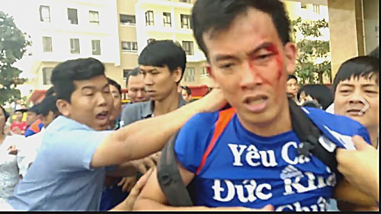 Căn hộ cao cấp không đủ chỗ để ô tô, có nên mua? Căn hộ cao cấp không đủ chỗ để ô tô, có nên mua?