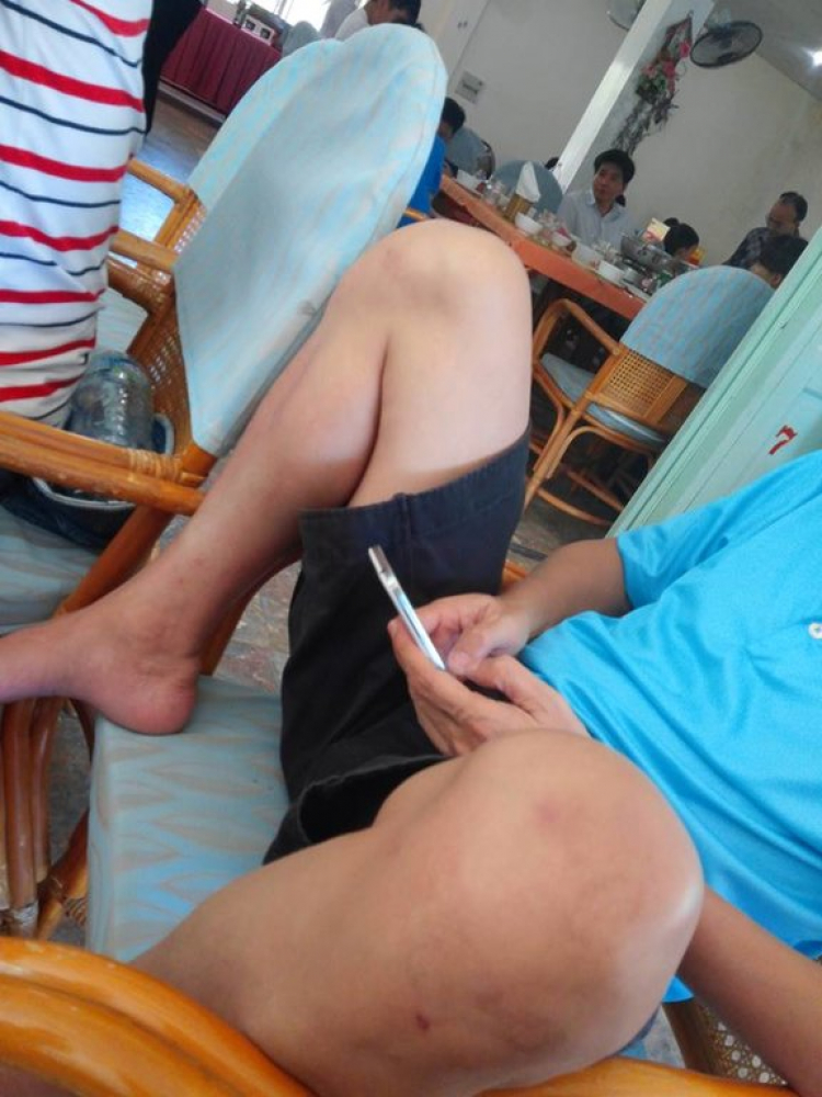 Góc Độ Xe Xóm Nhà Lá Góc Độ Xe Xóm Nhà Lá