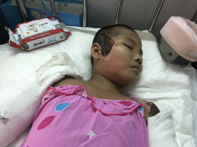 QUYÊN GÓP TỪ THIỆN: "4 người trên 1 xe 2b té - Xe tải cán chết 2 trọng thương 1" QUYÊN GÓP TỪ THIỆN: "4 người trên 1 xe 2b té - Xe tải cán chết 2 trọng thương 1"